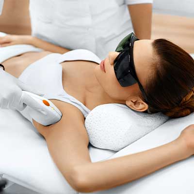 laser hair removal